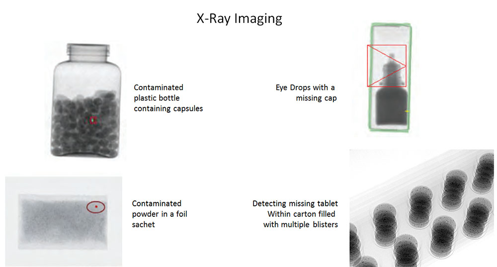 x ray
